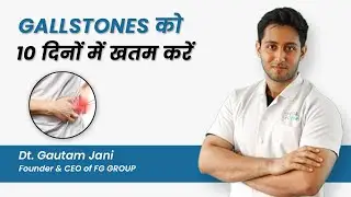 What Is Gallbladder Stone | Treat Gallbladder Stone In 10 Days | Diet & Exercise Plan Included