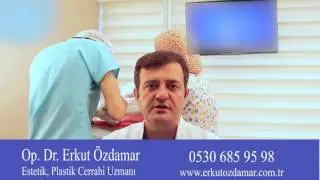 Şeker hastaları saç ektirebilir mi?