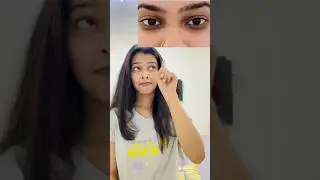 I’m Always Sleep Deprived😢എന്റെ കണ്ണിനെ രക്ഷിച്ചത് ഇവനാ👀💯