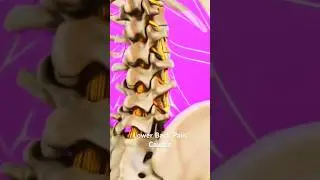 Lower Back Pain Causes