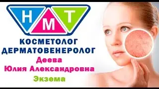 Экзема. Деева Юлия Александровна. Дерматолог, косметолог.