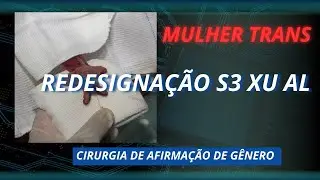 CRIAÇÃO DO CL! TÓ RIS DA MULHER TRANS