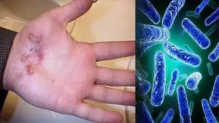WHAT HAPPENS WHEN YOU DON'T WASH YOUR HANDS...