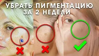 Как убрать пигментацию за 2 недели. Эффективная сыворотка для отбеливания кожи и следов от акне.