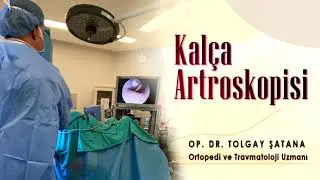 Kalça Artroskopisi