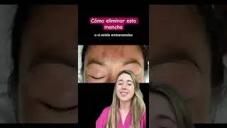 ¿Cómo eliminar esta mancha? 3 tips de #dermatologa #melasma #manchasenlacara #skincare #tips