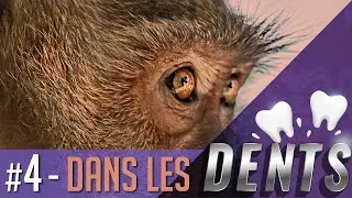 Dans les dents - Une histoire de guerre et d'hygiène bucco-dentaire - Clin d'Oeil #4