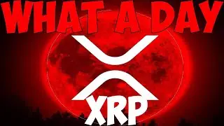 Ripple XRP I COULDNT BELIEVE MY FACE OMGGGGGGGGGGGGGGGGGGGGGGGGGGGGGG!!!