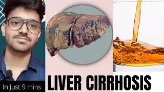 LIVER CIRRHOSIS : Must watch  Signs/ Symptoms /Pathophysiology #medico  #cirrhosis #neetpg