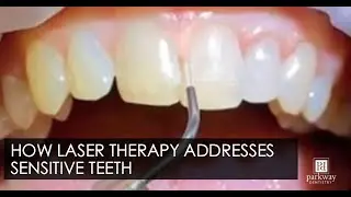 How Does Laser Therapy Help Address Sensitive Teeth
