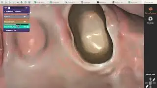 Nepřesnosti při digitálním otiskování