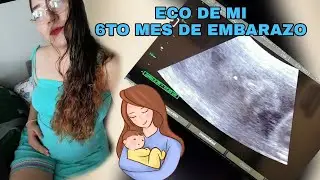semanas 24 de  embarazo así se ve en ECOGRAFIA - sexto mes EMBARAZOYMAS/ (ecografía)