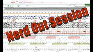 Polysomnography Nerd Out: Severe OSA Fixed, REM Rebound, PAP Titration Progression, Delta. Raw Data