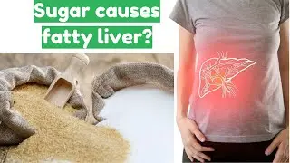 The Truth Behind Sugar And The Cause Of Fatty Liver