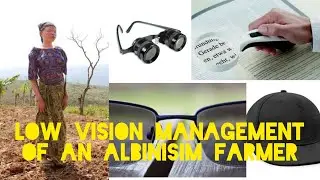 Low Vision Management