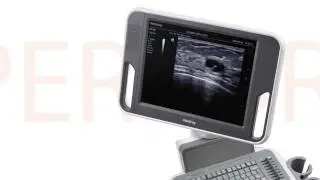 Máy siêu âm Doppler màu 4D DC N3 Mindray