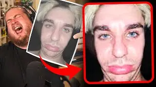 Purplecliffe Loses a Pokemon Every Time He Laughs LIVE #33