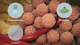 What is Immuno-oncology?