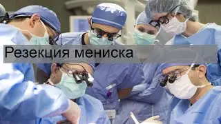 Резекция мениска