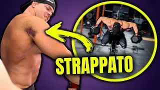 MI SONO STRAPPATO IL DELTOIDE