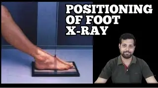 HOW TO DO X-RAY OF FOOT. #anatomy #xrayclasses #foot