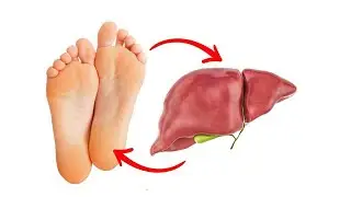 10 things your feet say about your liver!