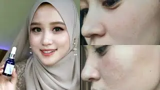 Review Skin Care Rutin Pagi Dan Malam Teraman || Aura Bright