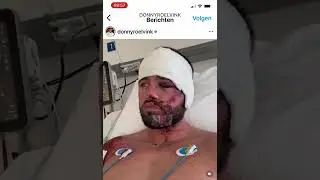 Donny gewond na autoongeluk