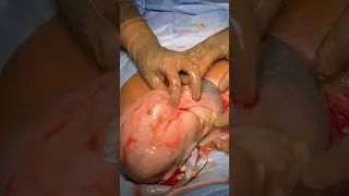 Baby inside it’s sac is the most beautiful thing in the world 🥹🥹🥹
