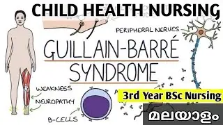 GUILLAIN - BARRE SYNDROME | 3rd Year BSc Nursing | CHILD HEALTH NURSING | Malayalam