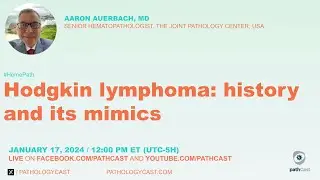 Hodgkin Lymphoma: history and its mimics