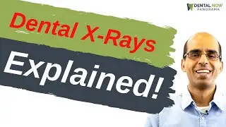 Dental X-Rays Procedure | Dentist Explained (2021)