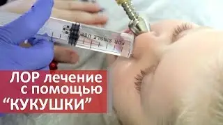 Лечение ЛОР органов. 👃 Эффективный способ лечения ЛОР органов. Центр Диагностика