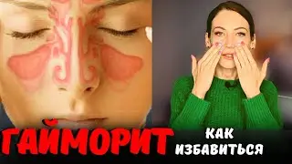 SINUSITIS - how to get rid of it. Psychosomatics of sinusitis.
