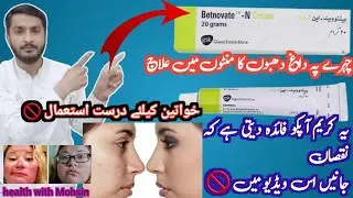 Betnovate n cream | betnovate cream ke fayde | betnovate cream uses in urdu | betnovate side effect|