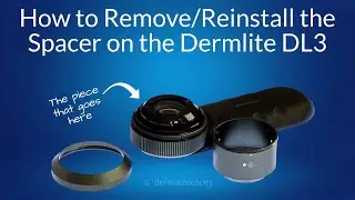 DermLite DL3N - Changing the Spacer