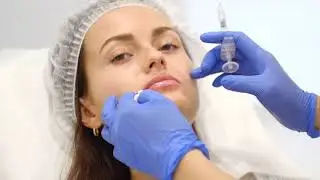 Контурная пластика губ - коррекция формы и увеличение