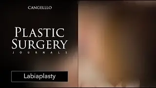 Labiaplasty Surgery | Plastic Surgery Journals | Cangello Plastic Surgery
