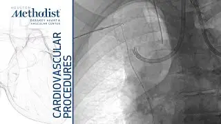 Superior Vena Cava Stenting (Maham Rahimi, MD, Luis Gomez, MD)