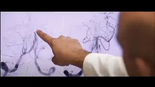 Sub-Specialty – Neurovascular | Department of Neurological Surgery | UCI School of Medicine
