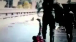Отрезанная рука