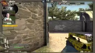 Arms Disabled CS:GO Player Plays With His Foot And Kills