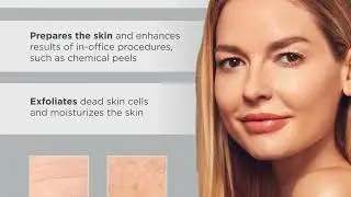 Top 5 Best Keratosis Pilaris Treatments Review
