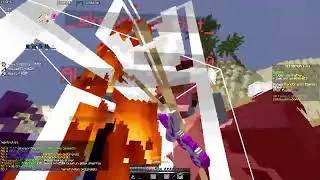 Pandorada Gökyüzü Kesme & Pandora PVP | Sonoyuncu Titanyum
