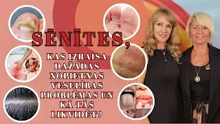 Sēnīšu izraisītas veselības problēmas. Nagu sēnīte. Piena sēnīte. Candida. Kā likvidēt sēnītes?