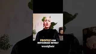 Alopecia Areata: Selbstliebe ohne Haare #glatze #alopecia #haarausfallfrau