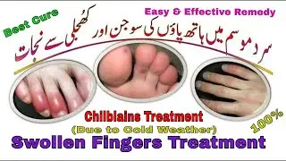 Get Rid Of Swollen Fingers I Chilblains Treatment I Treatment in Urdu