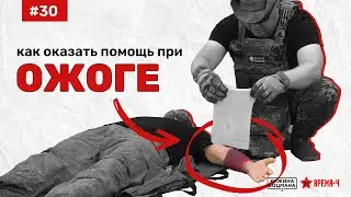 Что делать при ОЖОГЕ (ТЕМА №30)