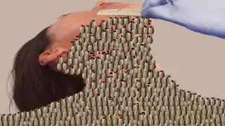 ASMR Treatment 2D Animation | Eradicating Dog Ticks Parasitic On The Neck |  @HealAsmr914K