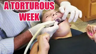 A Torturous Week | Orthodontist Removes Mara #seekyourtruth